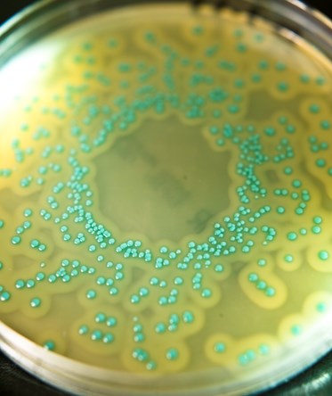 Listeria monocytogenes plate