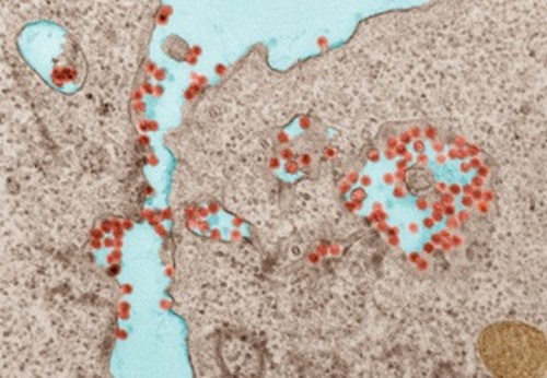 chikungunya in vero cells